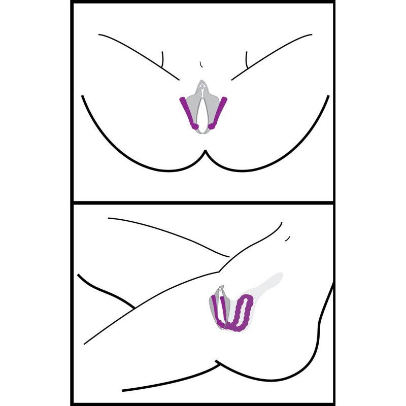 Oral Enhancing Hands Free Labia Spreader - Image 4